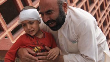 Un hombre sostiene a su hijo, quien fue herido en el ataque de ISIS.