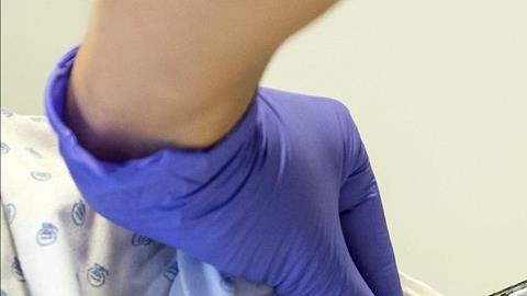 ebola