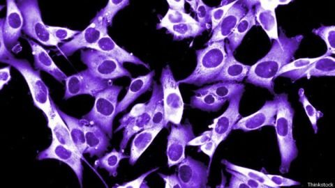 inmunoterapia cancer