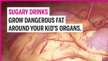 Las bebidas azucaradas pueden conducir a un aumento de la grasa visceral, la cual se acumula alrededor de los órganos.