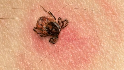 garrapata lyme