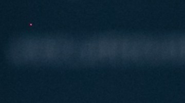 El expresidente Carter anunció la semana pasada que tenía melanoma en el cerebro.