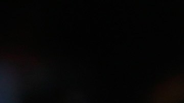 CC Sabathia, abridor de los Yankees, es atendido poco antes de abandonar el juego del domingo por lesión de la rodilla derecha.