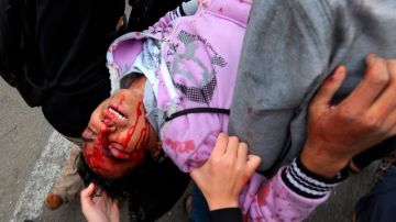 Un opositor recibe la ayuda de sus compañeros tras resultar herido durante los enfrentamientos con las fuerzas de seguridad egipcias, en El Cairo.