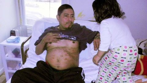 Juan Hernández, de 30 años, postrado en una cama de su hogar en Nueva Jersey.