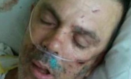 El hombre, identificado como Matthew Owens, aún se encuentra hospitalizado por encontrarse en condición crítica a raíz de los golpes que recibió.