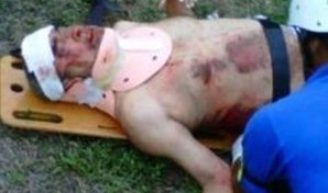Una fotografía sacada de Twitter alega que éste es Andy Montañez. cuando era atendido por los paramédicos en el lugar del accidente.