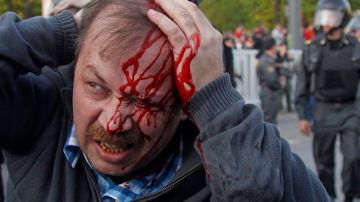 Un manifestante herido que protestaba contra la investidura de Vladimir Putin, en Moscú, Rusia.