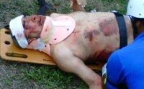 Una fotografía sacada de Twitter alega que éste es Andy Montañez. cuando era atendido por los paramédicos en el lugar del accidente.