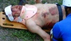 Una fotografía sacada de Twitter alega que éste es Andy Montañez. cuando era atendido por los paramédicos en el lugar del accidente.
