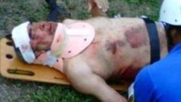 Una fotografía sacada de Twitter alega que éste es Andy Montañez. cuando era atendido por los paramédicos en el lugar del accidente.