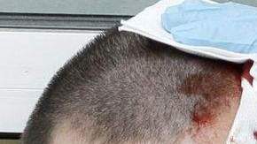 Un manifestante es atendido por golpes en la cabeza.