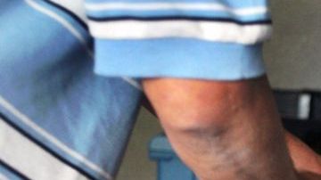 Pedro Granadas, de 52 años, hace más de 30 años que es sobador. Granadas masajea la espalda de un cliente.