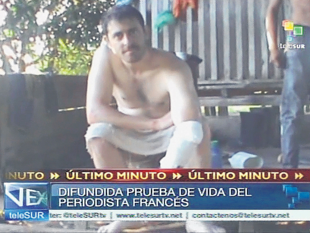 Imagen del vídeo  de Telesur donde se ve al periodista francés, Romeo Langlois, sentado y con un brazo vendado.