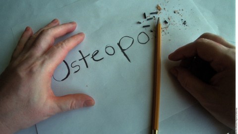 Si se padece osteoporosis es importante prevenir las fracturas.