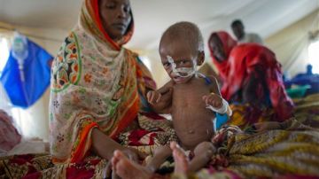 Una madre proporcionando nutrición vía nasal a su hijo en Chad.