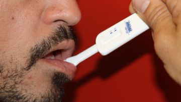 El examen oral del VIH no prueba la  saliva  sino la mucosa  que está en las encías.