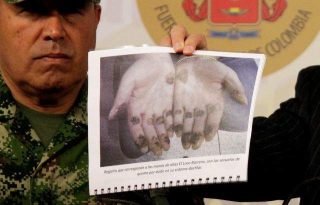 El ministro colombiano de Defensa de de Colombia muestra una fotografía de las manos del narcotraficante Daniel Barrera,  que se las quemó para borrar sus huellas dactilares.