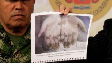 El ministro colombiano de Defensa de de Colombia muestra una fotografía de las manos del narcotraficante Daniel Barrera,  que se las quemó para borrar sus huellas dactilares.