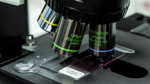 Se calcula que las inyecciones contaminadas fueron administradas a unas 14 mil personas entre mayo y septiembre.