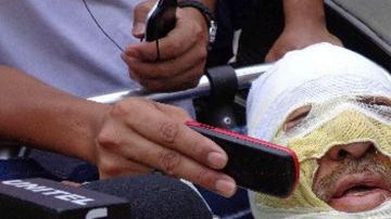 El periodista boliviano Fernando Vidal, haciendo declaraciones a los medios en Yacuiba, Bolivia, donde fue quemado por desconocidos cuando conducía un programa radial.