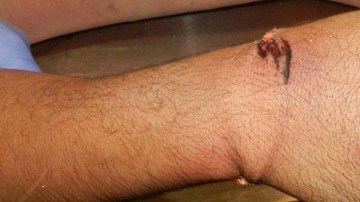 Lesiones en los brazos de José Sauceda, que murió en un hospital bajo custodia policial.