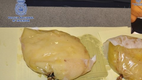 Composición fotográfica facilitada por la Policía Nacional que detuvo en el aeropuerto de El Prat a una pasajera de un vuelo procedente de Colombia que llevaba implantadas dos prótesis mamarias rellenas con más de dos libras de  cocaína.