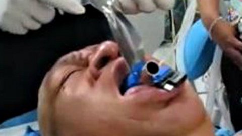 Causa revuelo esta foto que se decía era de "Hugo Chávez entubado".