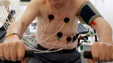 Un hombre se somete a un electrocardiograma: las mujeres son  más propensas a infartos inesperados que ellos.