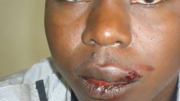Cazana Senet muestra las heridas  luego de ser golpeado por un militar.