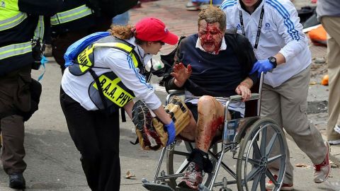 Personal intentaba ayudar a este hombre cuyo rostro evidencia el dolor extremo que le causaron las explosiones en Boston.