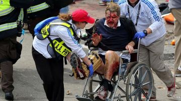 Personal intentaba ayudar a este hombre cuyo rostro evidencia el dolor extremo que le causaron las explosiones en Boston.