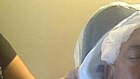 Oscar D'León se recupera de una intervención quirúrgica de un ojo.