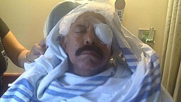 Oscar D'León se recupera de una intervención quirúrgica de un ojo.