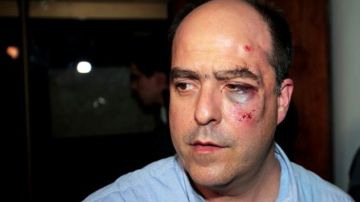 El diputado opositor Julio Borges  fue uno de los diputados opositores golpeados en la sesión de de la Asamblea Nacional, en Caracas, Venezuela).