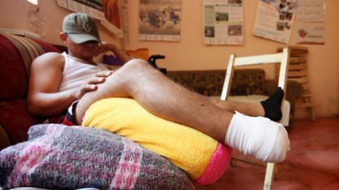 Un migrante herido se recupera en un refugio de Acayucan, Veracruz.