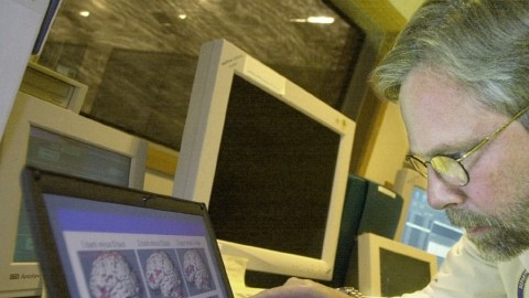 Un médico examina imágenes  de conmociones cerebrales.