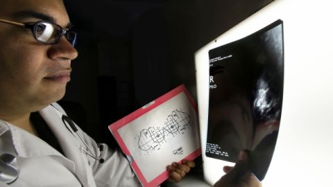 El Dr. Raymundo Romero, oncólogo del Centro de Cáncer Cecilia González de La Hoya, revisa unas radiografías de seno.