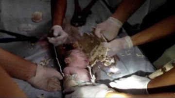En esta imagen tomada de la televisión se observa al recién nacido dentro del tubo de desagüe y los recatistas tratan de liberarlo de  la tubería.