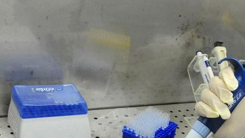 Las autoridades de Salud indicaron que las muertes se produjeron en las últimas seis semanas
