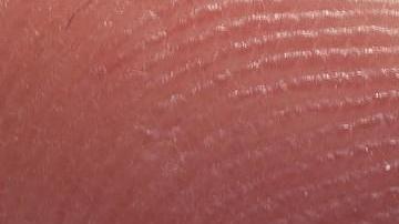 La diabetes intoxica la sangre.