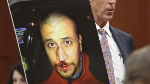 Mark O'Mara, abogado de George Zimmerman, muestra una foto del acusado con el rostro golpeado -alegadamente- por el fenecido Trayvon Martin.
