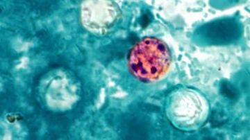Imagen de una de las muestras de la ensalada mixta tomadas por las autoridades de Salud en Estados Unidos. En rojo se destaca la presencia de la bacteria Cyclospora.