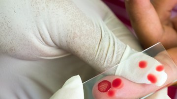 De sospechar que padece de dengue, visite un centro de salud para que le hagan las pruebas correspondientes.