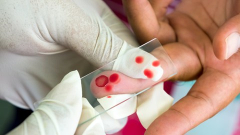 De sospechar que padece de dengue, visite un centro de salud para que le hagan las pruebas correspondientes.