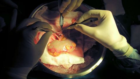 Las operaciones para recuperar la salud del riñón serían cosa del pasado si los científicos avanzan en sus trabajos con las células madre.