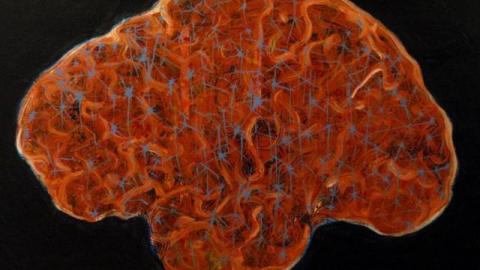 Una alimentación adecuada es importante para la salud cerebral.