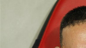 El delantero francés Franck Ribery no pudo recuperarse de la una lesión en la espalda