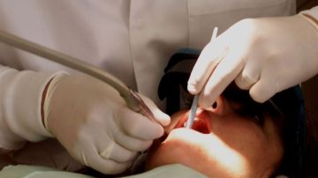 Aparte de tener una buena higiene bucal, se sugiere visitar a un dentista regularmente.