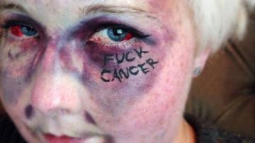 “No voy a dejar que el cáncer arruine mi vida”, indicó Cartwright.
